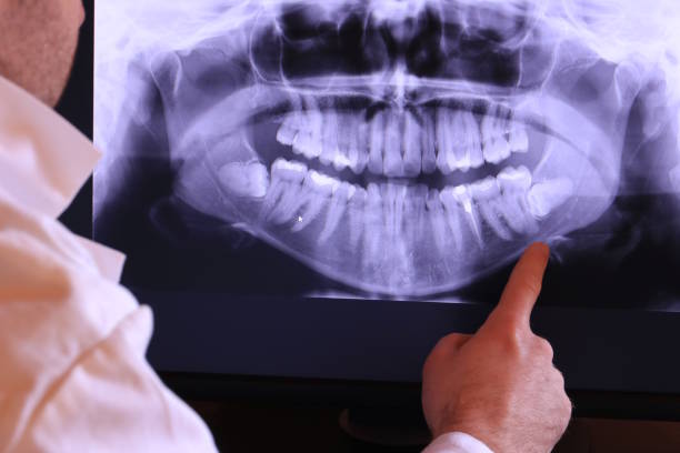 Best Emergency Dental Surgery in Long Grove, IL