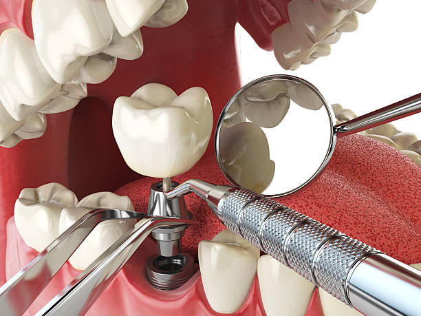 Best Emergency Dental Surgery in Long Grove, IL